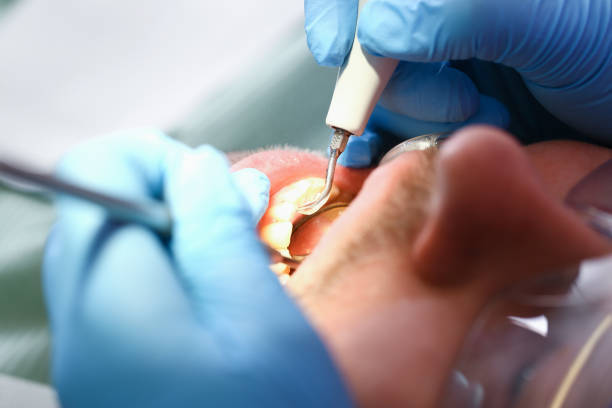 Best Emergency Root Canal Treatment in Edwards, MS