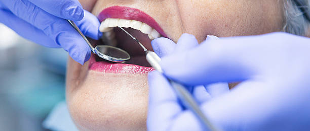 Best Emergency Dentist for Lost Fillings or Crowns in Edwards, MS